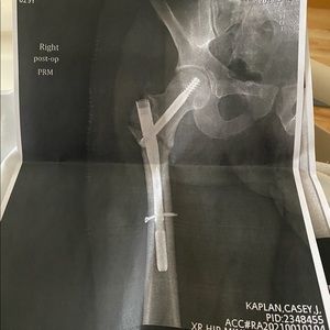 Meet your Posher, Casey